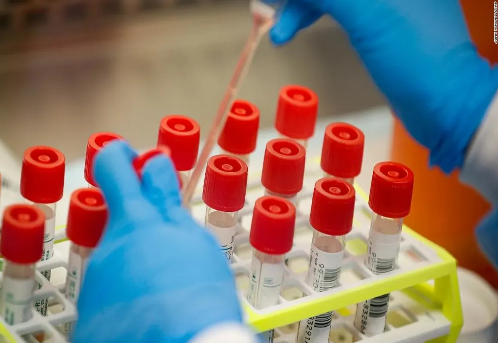 Patru noi cazuri de coronavirus în Olt, printre care o asistentă de la DSP