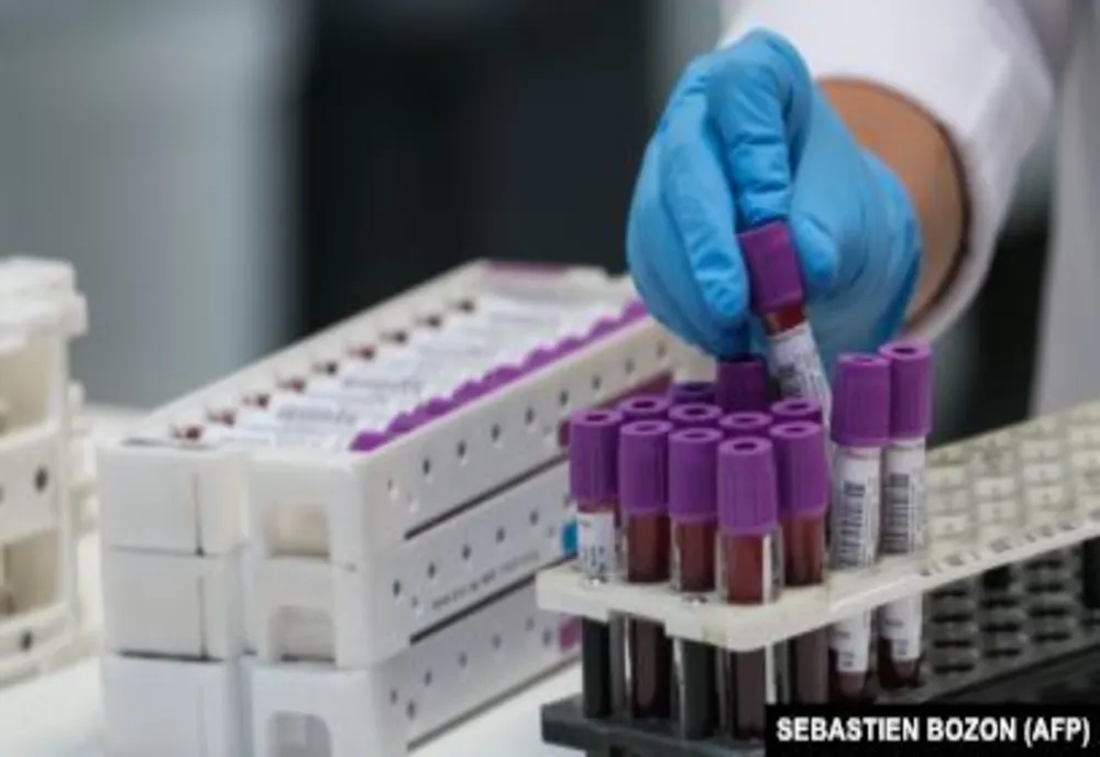 Olt: 11 cazuri noi de coronavirus, raportate 