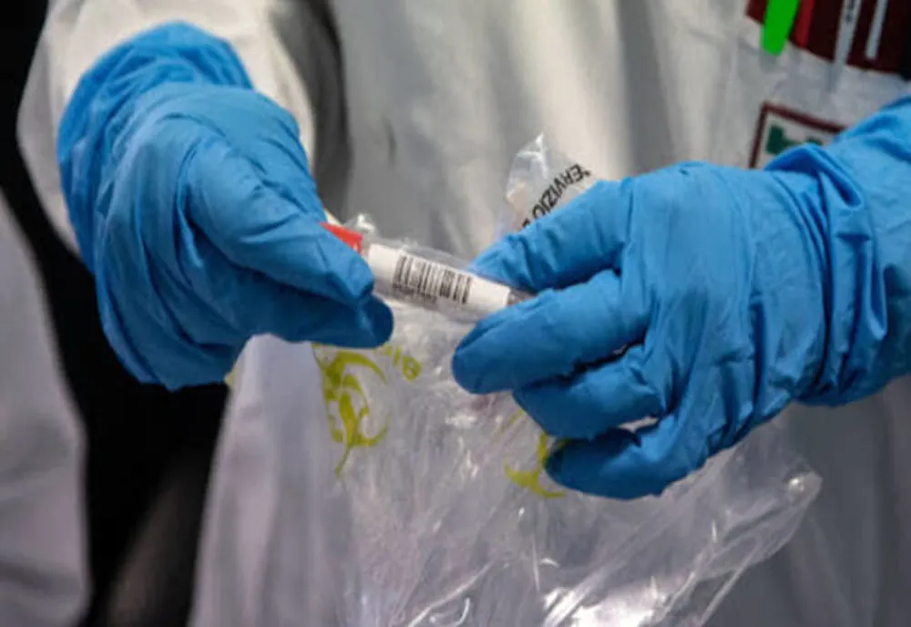 Coronavirus la vârful DSP Olt. Directorul instituţiei, testat pozitiv