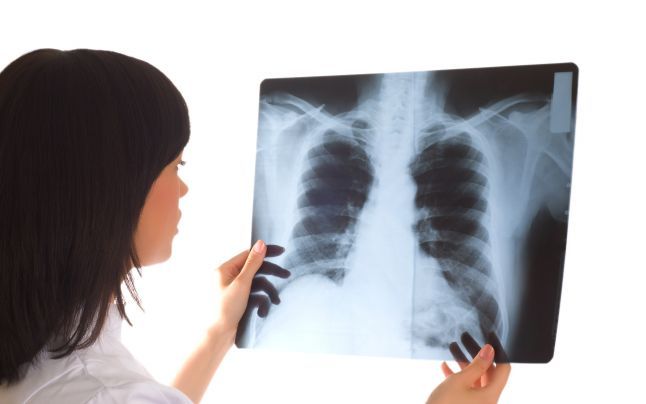 Scandalul radiografiilor de la Spitalul Slatina. Unele aparțineau altor medici