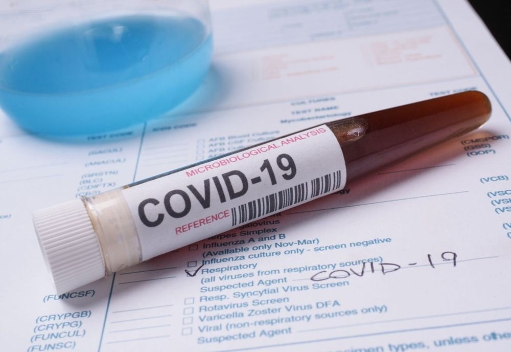 80 de cazuri de coronavirus în judeţul Olt. Nicio îmbolnăvire nouă, în ultimele 24 de ore