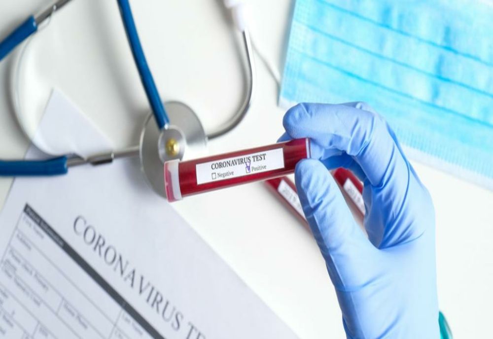 Coronavirus la APIA Caracal