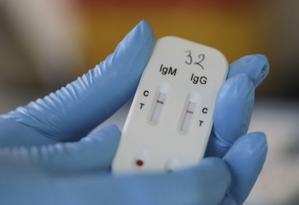 În două farmacii din Olt se fac teste rapide pentru depistarea COVID, gratuit