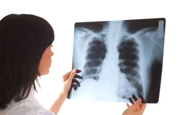radiografii