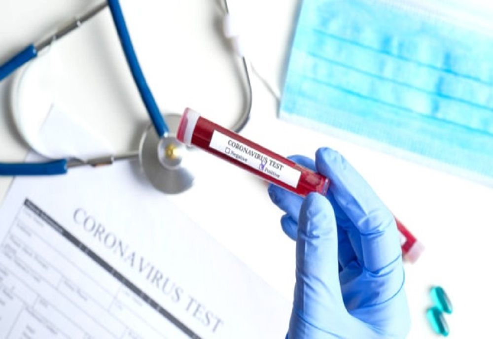 Bani din Fondul al CJ Olt pentru achiziţia laboratorului pentru testarea coronavirusului. Va putea face 196 de teste pe zi