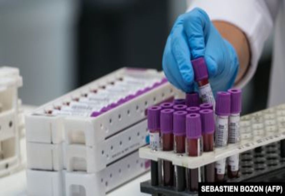 Olt: 11 cazuri noi de coronavirus, raportate