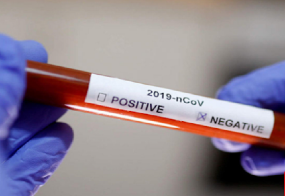 COVID-19|Mai multe instituții din județul Olt afectate