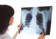 Scandalul radiografiilor de la Spitalul Slatina. Unele aparțineau altor medici