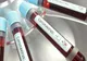 Fără cazuri noi de coronavirus, în judeţul Olt