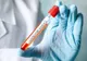 Coronavirus | Situaţia la zi, în judeţul Olt