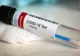 Focar de coronavirus, în creştere, la un Centru pentru persoane cu dizabilităţi din Caracal