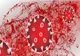 Bilanț coronavirus - 5 septembrie  - Autoritățile anunță noile statistici - Câte infectări s-au înregistrat în ultimele 24 de ore